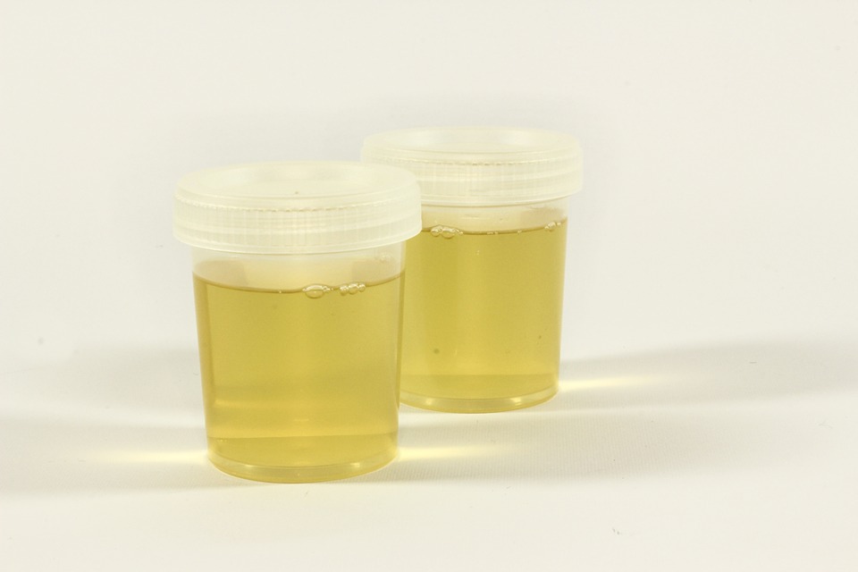 test urine container